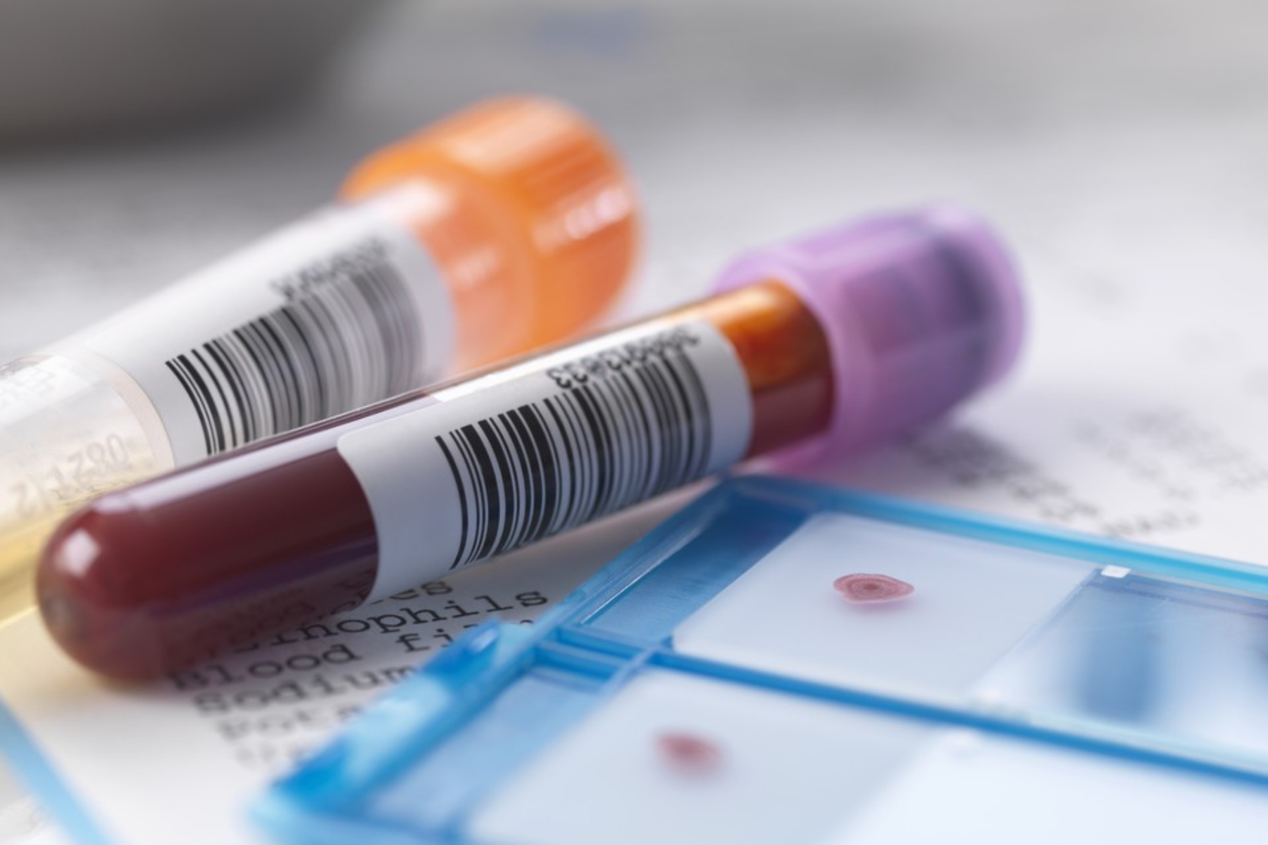 Εξέταση αίματος: Πόσο συχνά πρέπει να κάνουμε εξετάσεις αίματος;