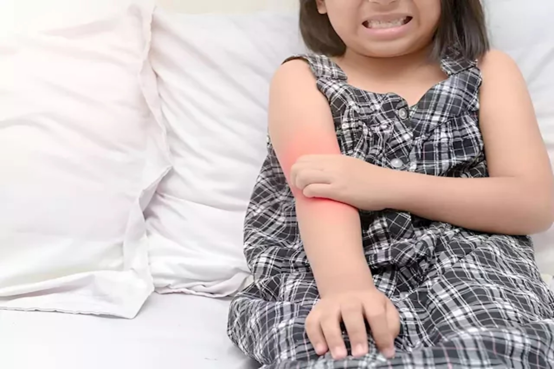 Έκζεμα παιδιά: Τα παιδιά με έκζεμα χρειάζονται περαιτέρω αλλεργικά τεστ