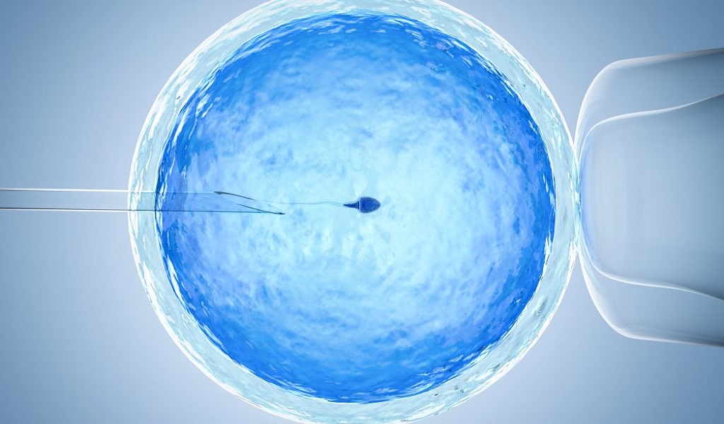Ερευνητές μελετούν σχεδόν 1.000 προσπάθειες γονιμότητας, ελπίζοντας να βελτιώσουν την εξωσωματική γονιμοποίηση