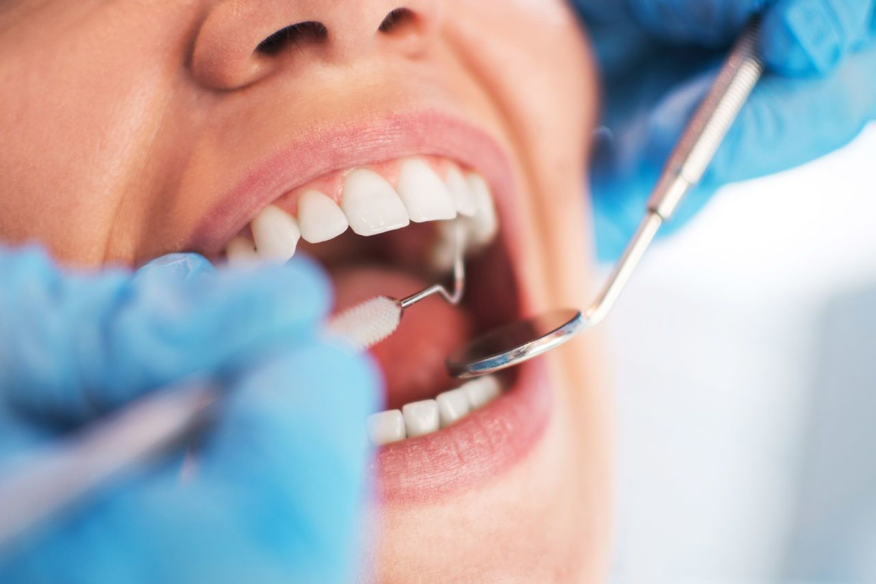 Η έλλειψη οδοντιάτρων στο NHS εγείρει ανησυχία για θανάτους από καρκίνο στόματος
