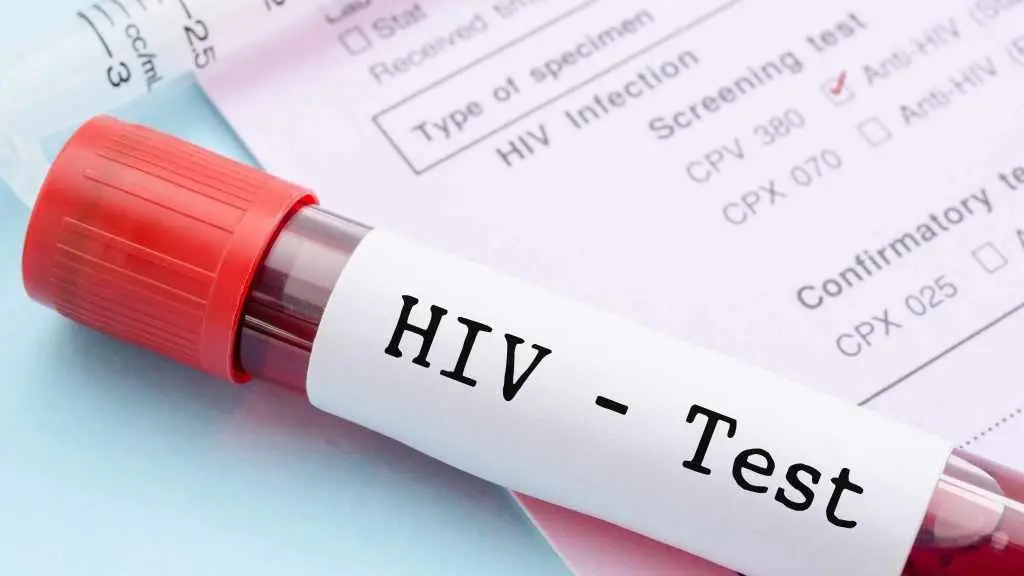 HIV - Ο ιός με δομές αυτοπροστασίας έναντι αναγνώρισης και επίθεσης από αντισώματα και θεραπευτικά μέσα.