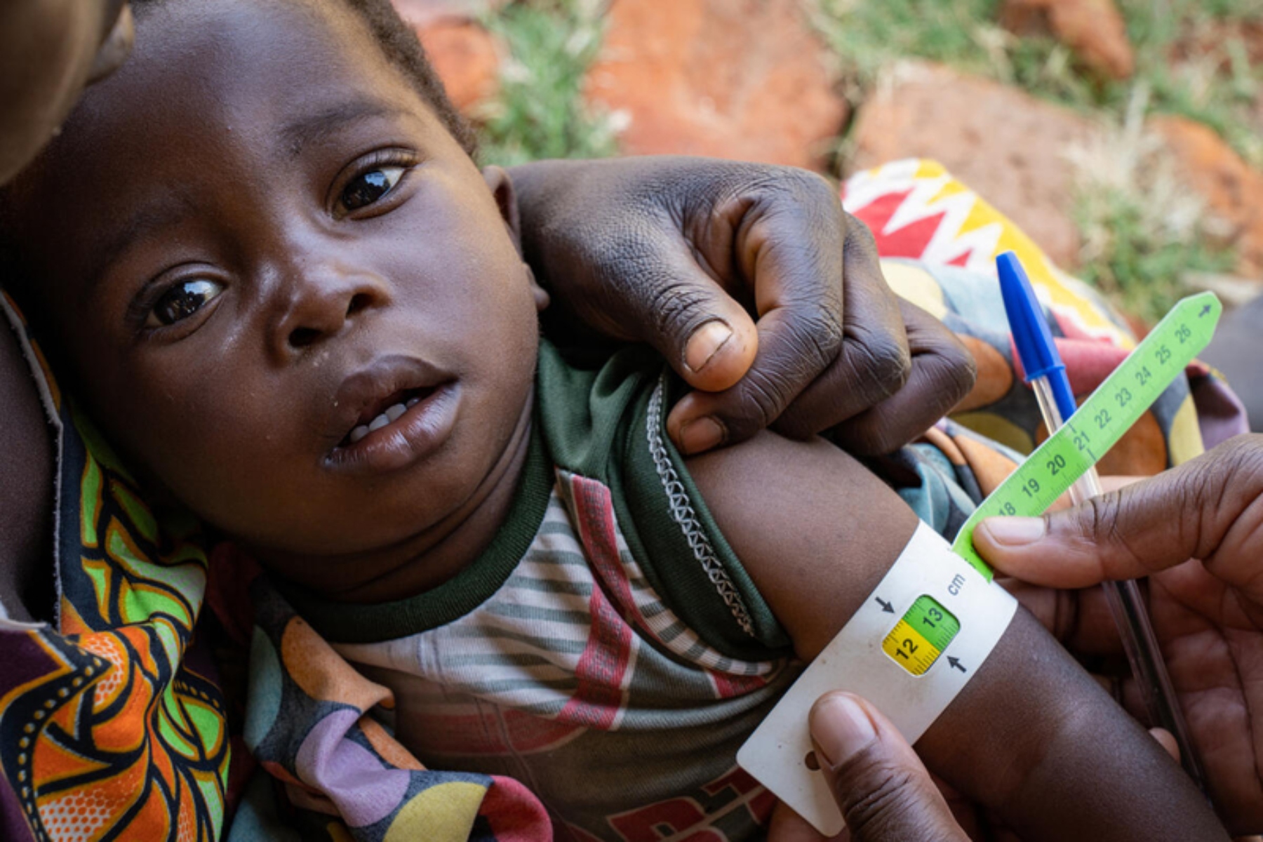 ΠΟΥ: Νέες οδηγίες για την αντιμετώπιση του υποσιτισμού σε παιδιά κάτω των πέντε ετών