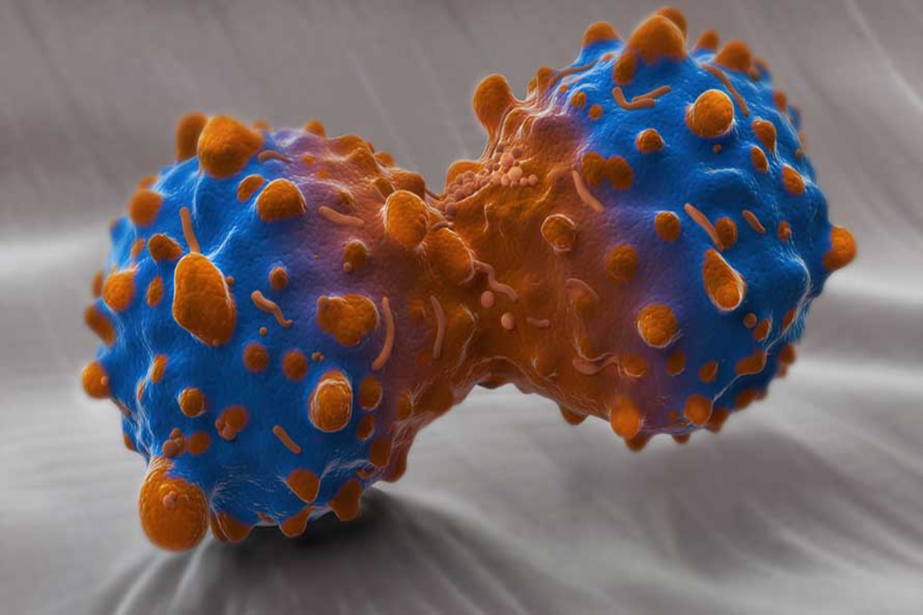 Καρκίνος πνεύμονα: Τα εργαστήρια φέρνουν επανάσταση στις εξετάσεις για τον καρκίνο του πνεύμονα