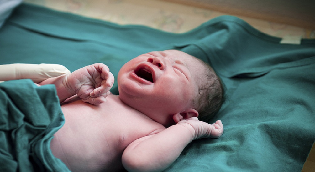 Ομφάλιος Λώρος: Η καθυστερημένη σύσφιξή του μειώνει τον κίνδυνο θανάτου σε πρόωρα μωρά