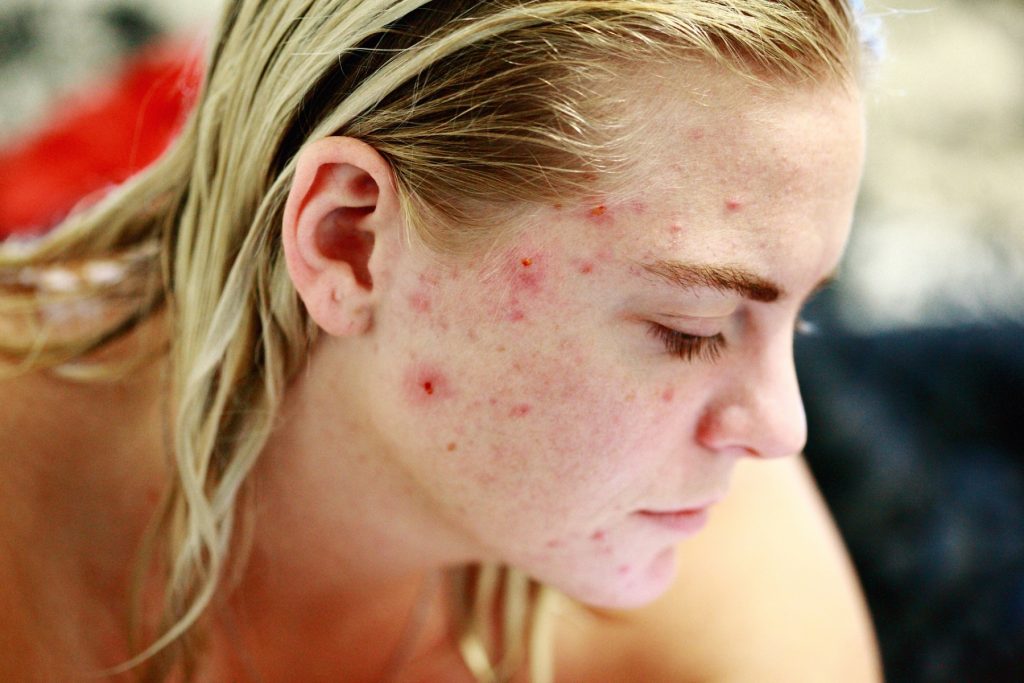Τι συμβαίνει στο δέρμα σας όταν κοιμάστε με μακιγιάζ
