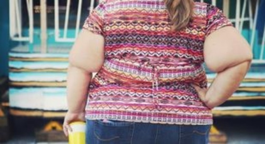 Παχυσαρκία: Ο Πανελλήνιος Σύλλογος ΙΜΕΡΟΕΣΣΑ στηρίζει τα άτομα με τη νόσο