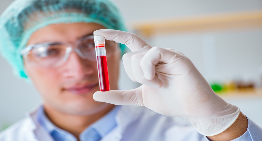 Καρκίνος του Προστάτη: Εξελισσόμενες γνώσεις στις υγρές βιοψίες με βάση το αίμα για την εξέταση της νόσου