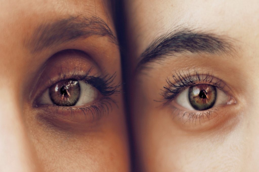 Ποια είναι τα αίτια των μαύρων κύκλων γύρω από τα μάτια;