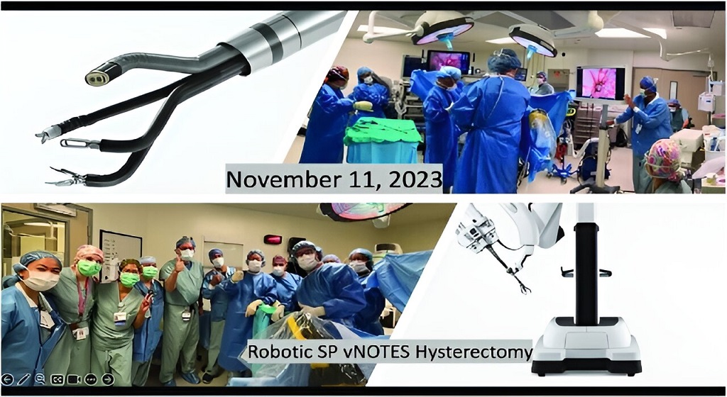 Ρομποτική Πλατφόρμα Μονής Θυρίδας: Για διακολπική ενδοαυλική ενδοσκοπική χειρουργική με φυσικό στόμιο