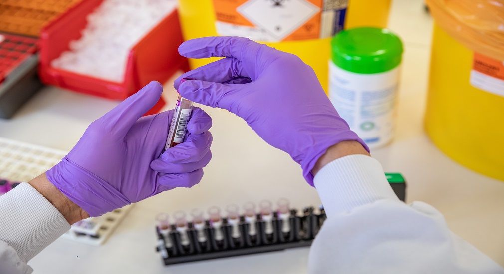 Μεταγγίσεις: Ερευνητές εντοπίζουν νέο βιοδείκτη στην ποιότητα της αιμοδοσίας