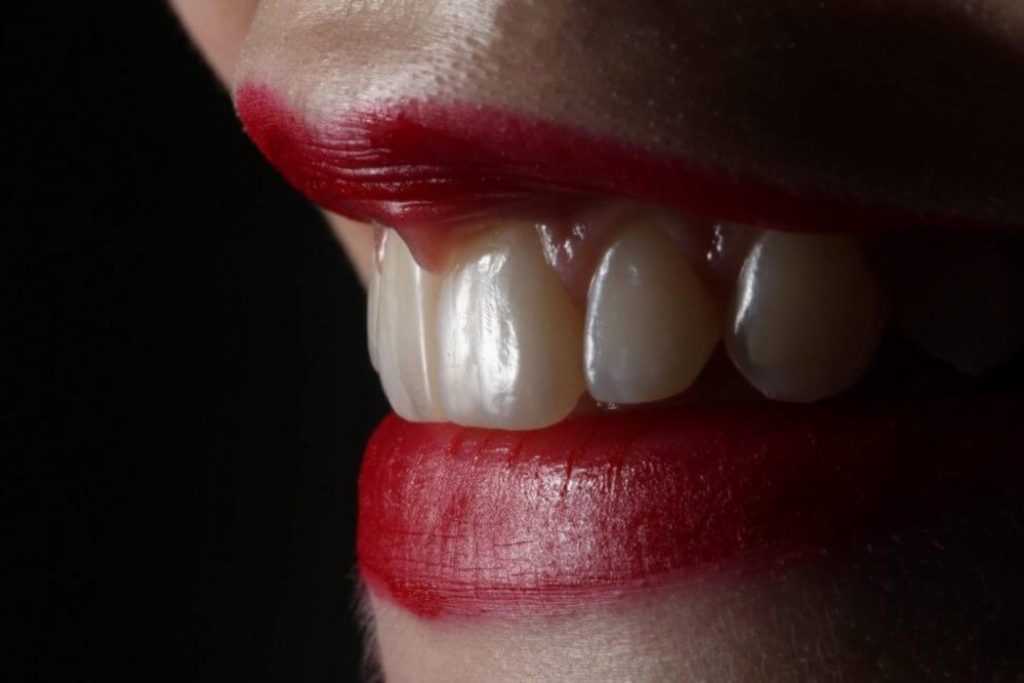 Τι είναι αυτό που μπορεί να οδηγήσει σε διάβρωση του σμάλτου των δοντιών;