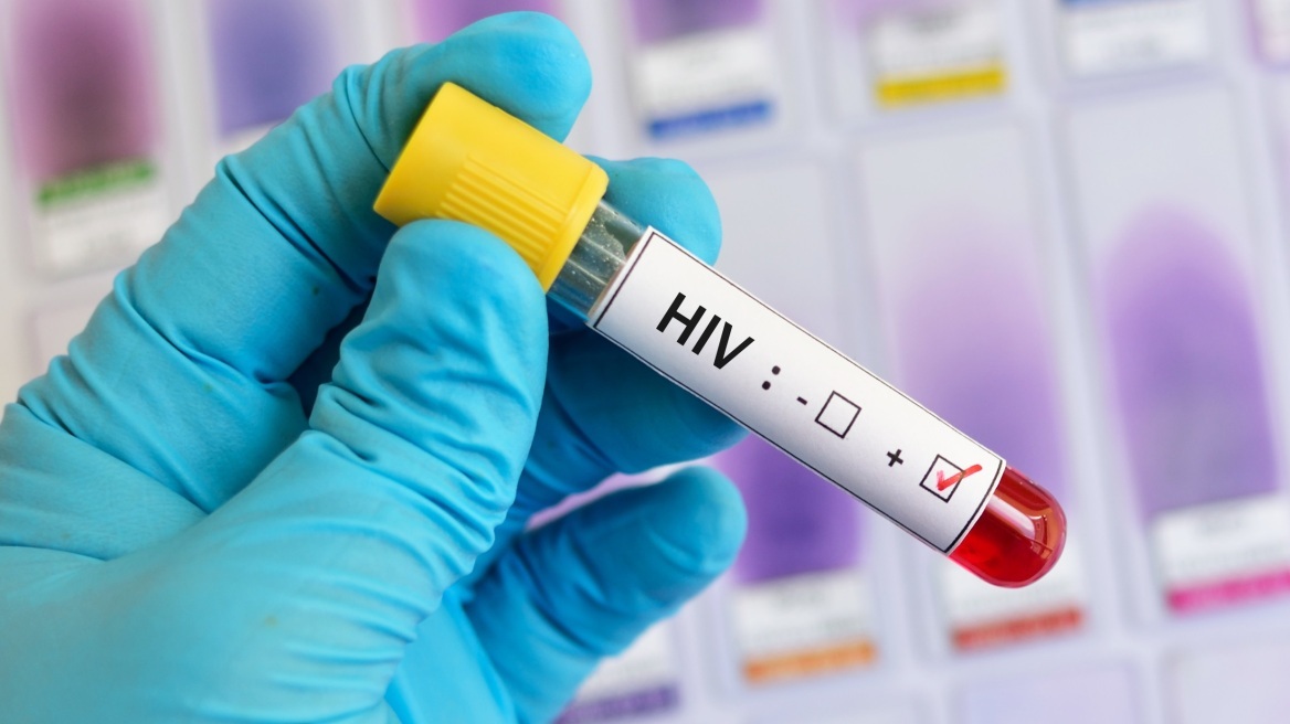 HIV: Πώς ο ιός εισέρχεται στο κέντρο του κυττάρου για να ξεκινήσει τη μόλυνση