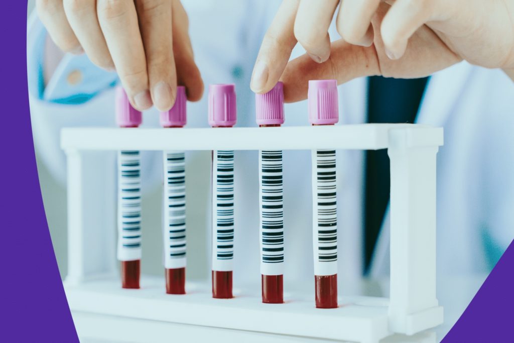  Τι είναι τα επίπεδα MCH στις εξετάσεις αίματος;
