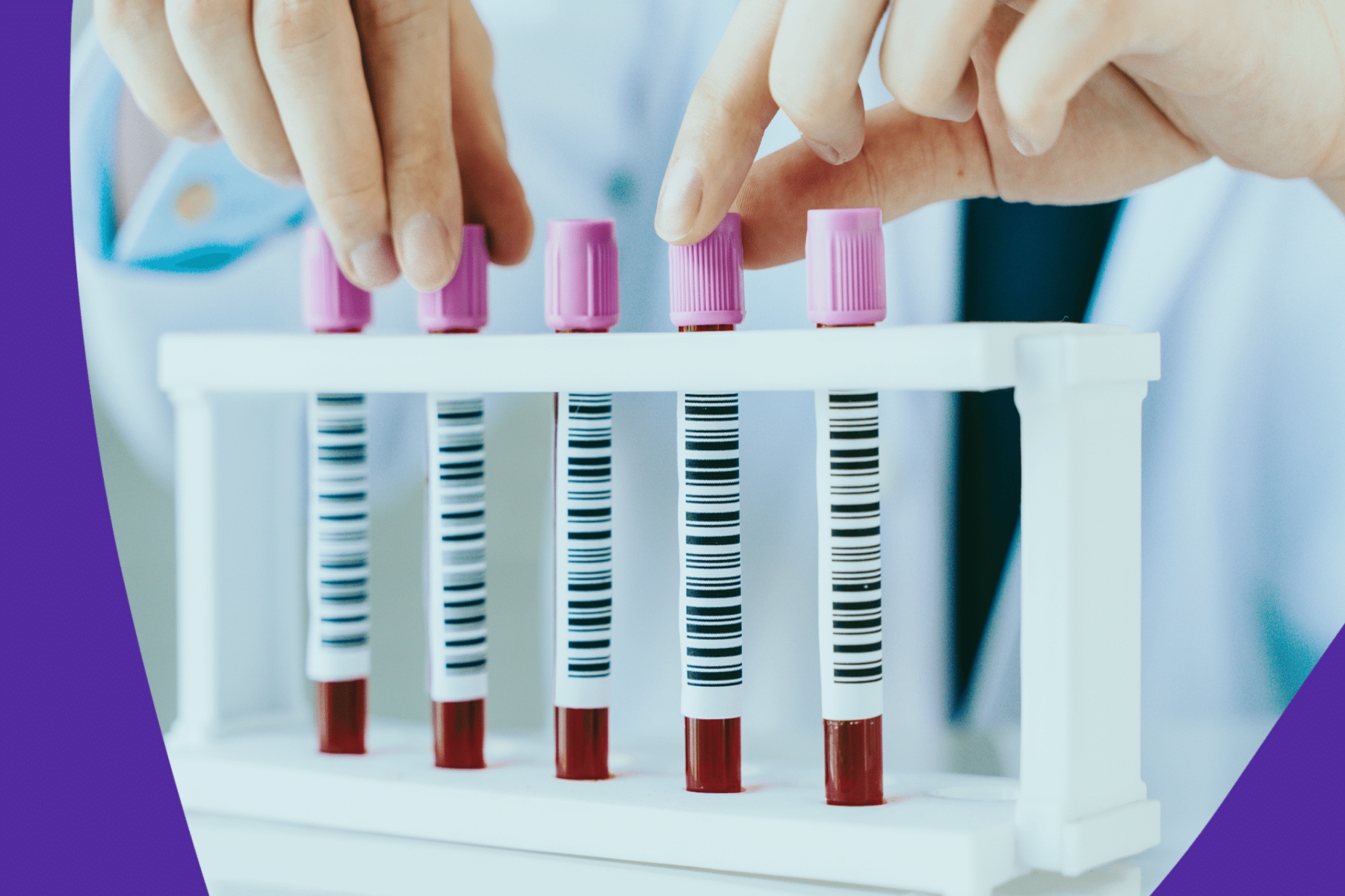 MCH αίμα: Τι είναι τα επίπεδα MCH στις εξετάσεις αίματος;