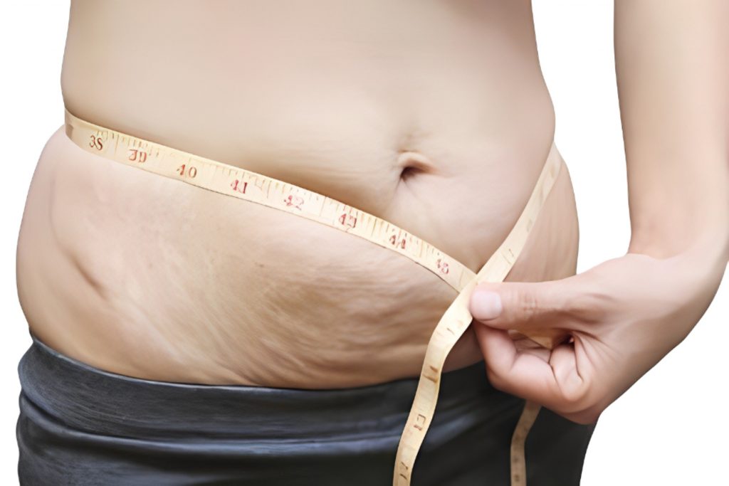 Γιατί είναι δύσκολη η απώλεια βάρους μετά τον τοκετό;