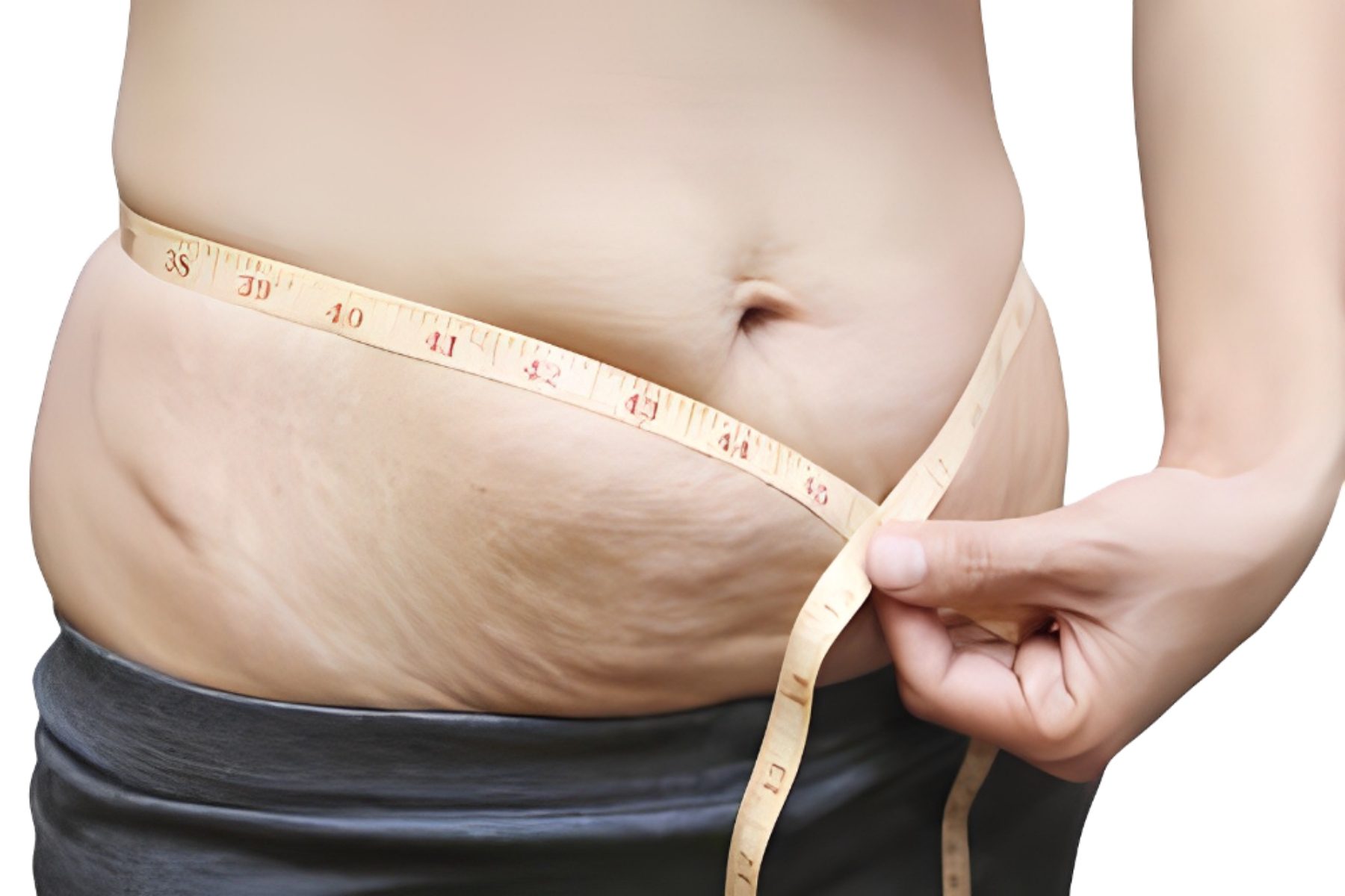 Τοκετός βάρος: Γιατί είναι δύσκολη η απώλεια βάρους μετά τον τοκετό;