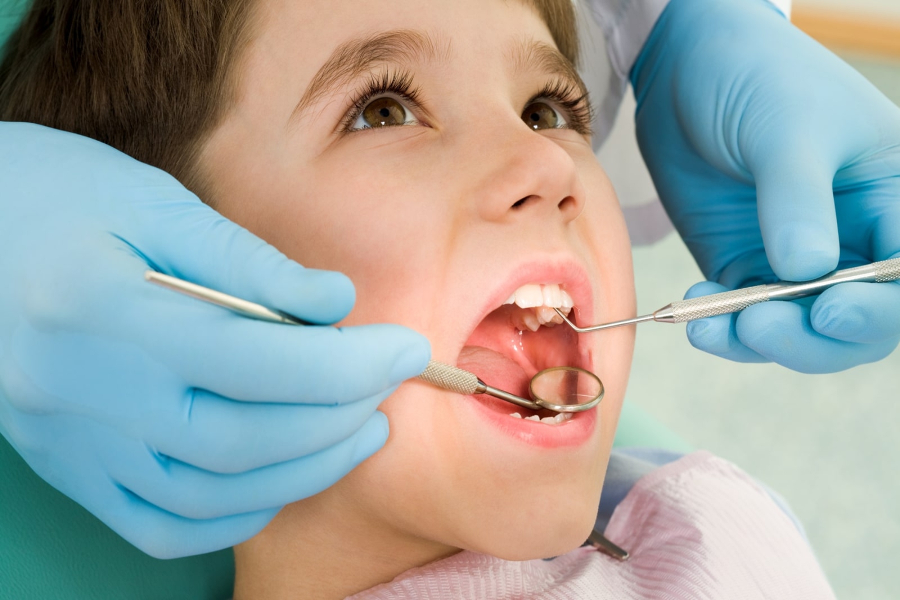 Τερηδόνα παιδιά: Προσέξτε αυτά τα πρώιμα σημάδια τερηδόνας στα παιδιά για να προστατέψετε τα δόντια τους