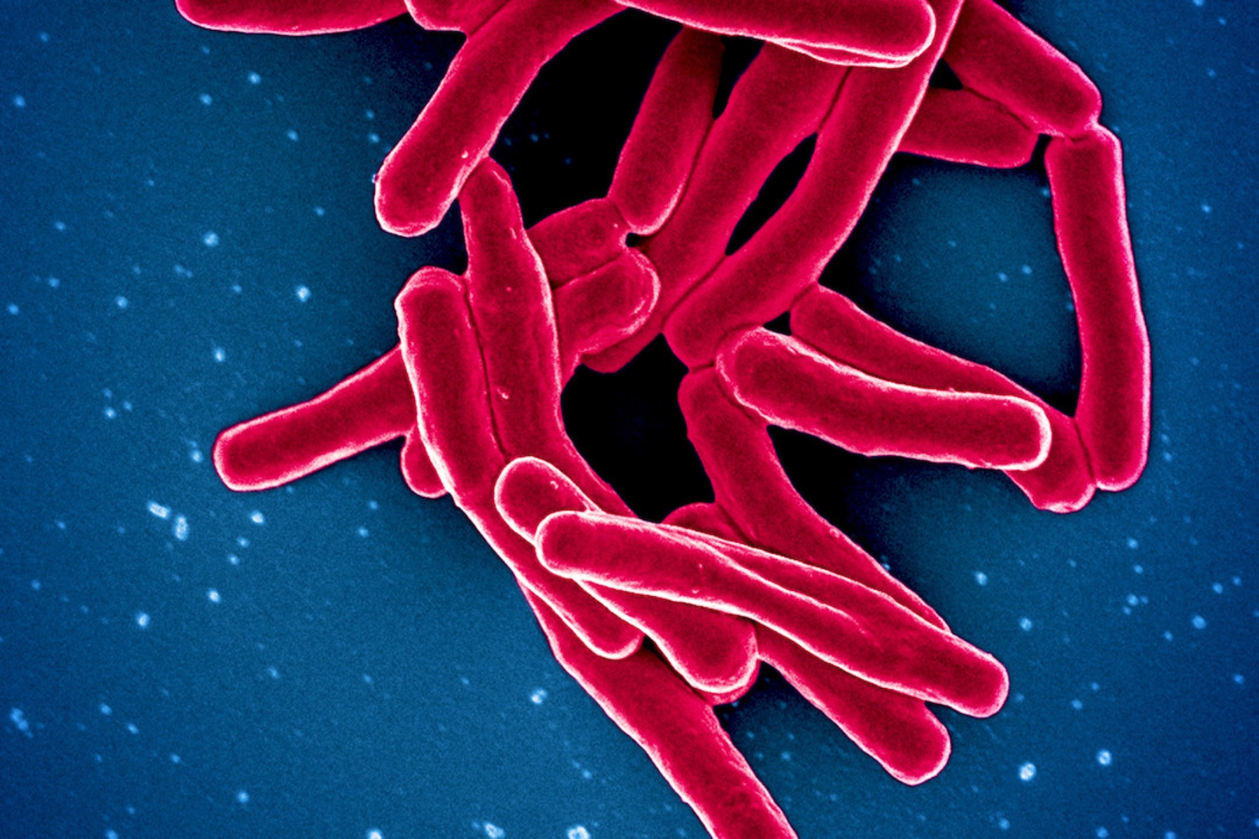 Με ποιον τρόπο τα Τ κύτταρα καταπολεμούν τη φυματίωση;