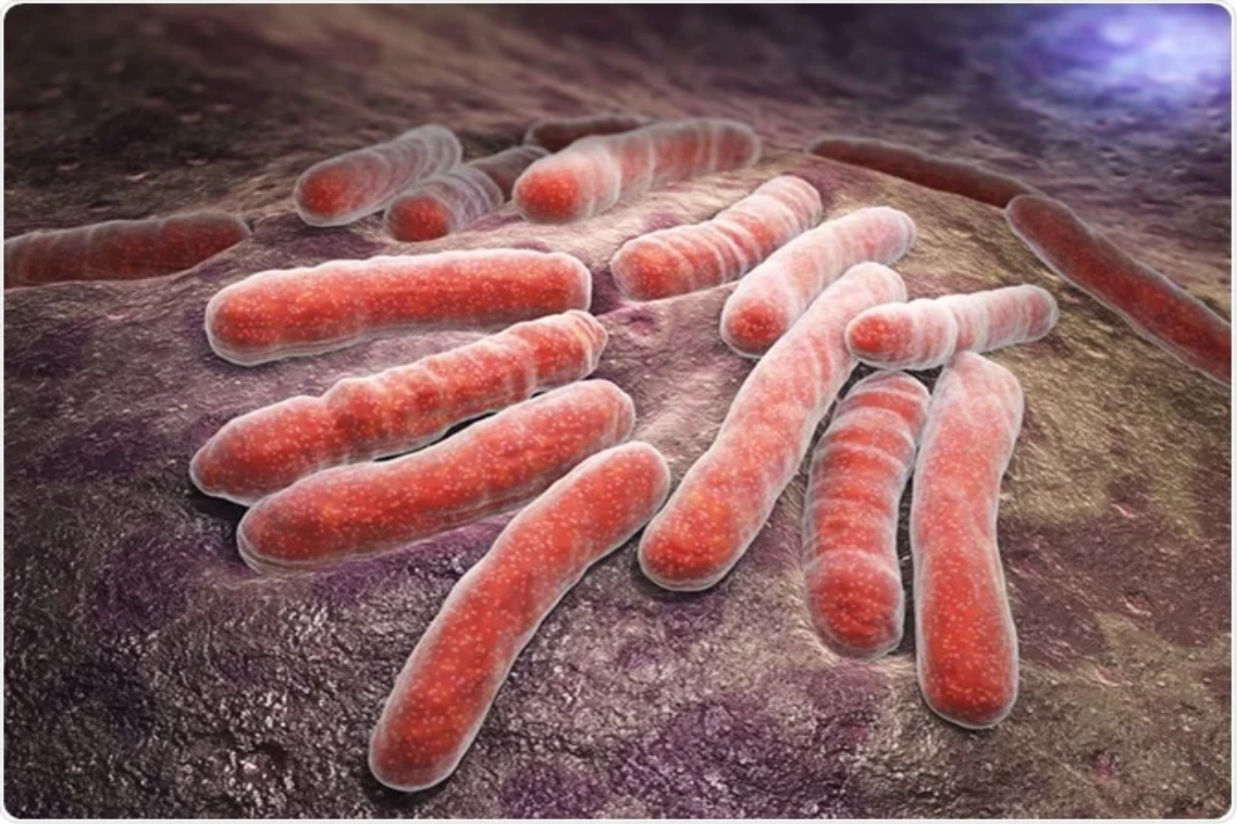 Νέα ταξινόμηση της φυματίωσης για την εξάλειψη της νόσου