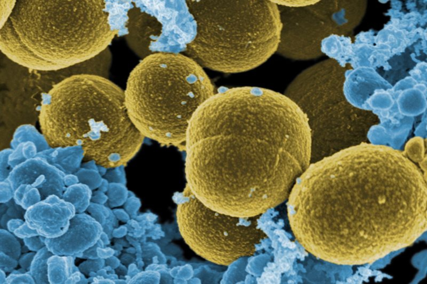 Ερευνητές μικρόβια: Καινούργιο εργαλείο δημόσιας αναζήτησης που αντιστοιχίζει τα μικρόβια με τους μεταβολίτες