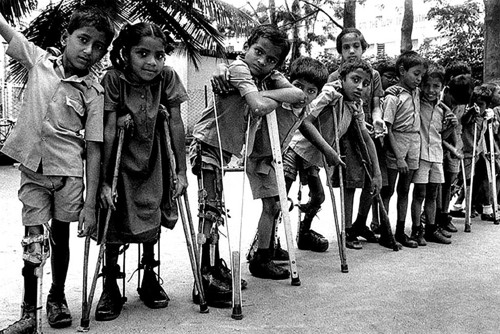 Εξαφανίστηκε η πολιομυελίτιδα από την Ινδία;