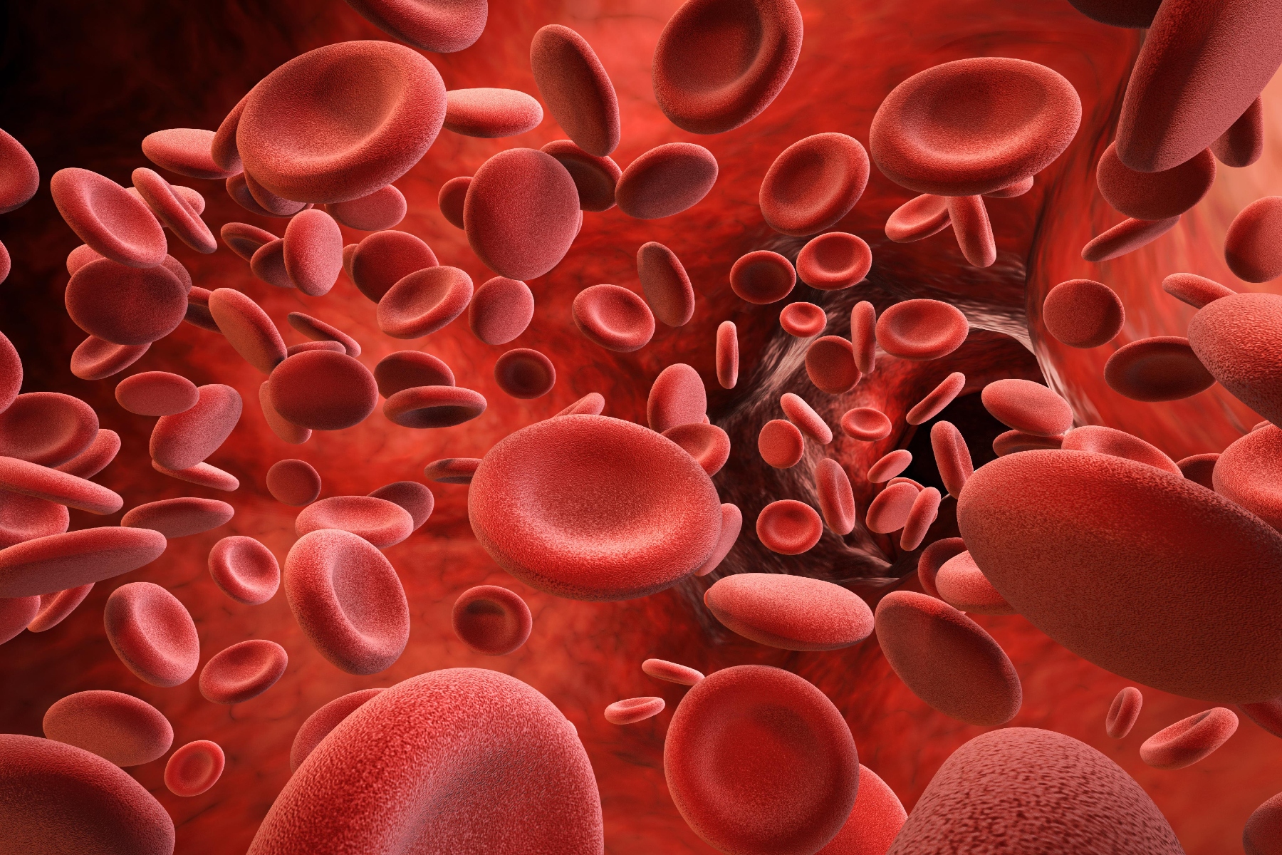 Αιμοχρωμάτωση: Υψηλότερα επίπεδα ασθένειας στους ηλικιωμένους