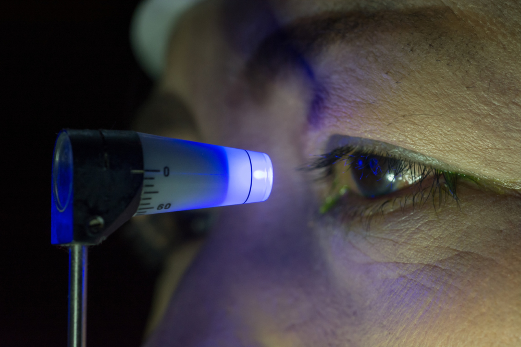 Υγεία ματιών: Μπορεί η χαμηλή εγκεφαλική πίεση να παίξει ρόλο στην ανάπτυξη του γλαυκώματος;