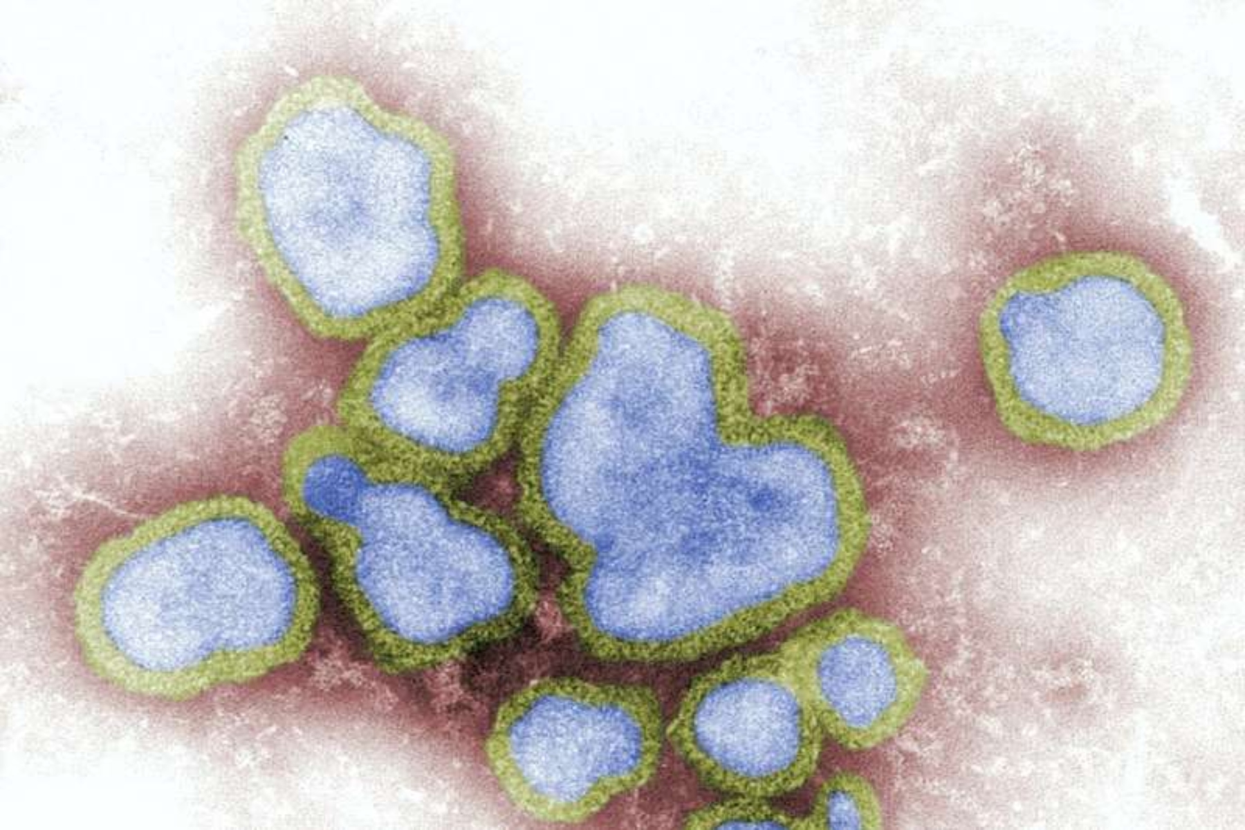 Γρίπη: Το Νο 1 παθογόνο που προκαλεί ανησυχία για το ενδεχόμενο πανδημίας
