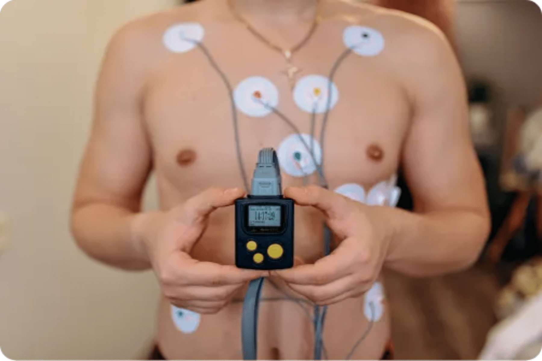Holter ρυθμού: Πότε είναι απαραίτητο ένα 24ωρο holter ρυθμού;