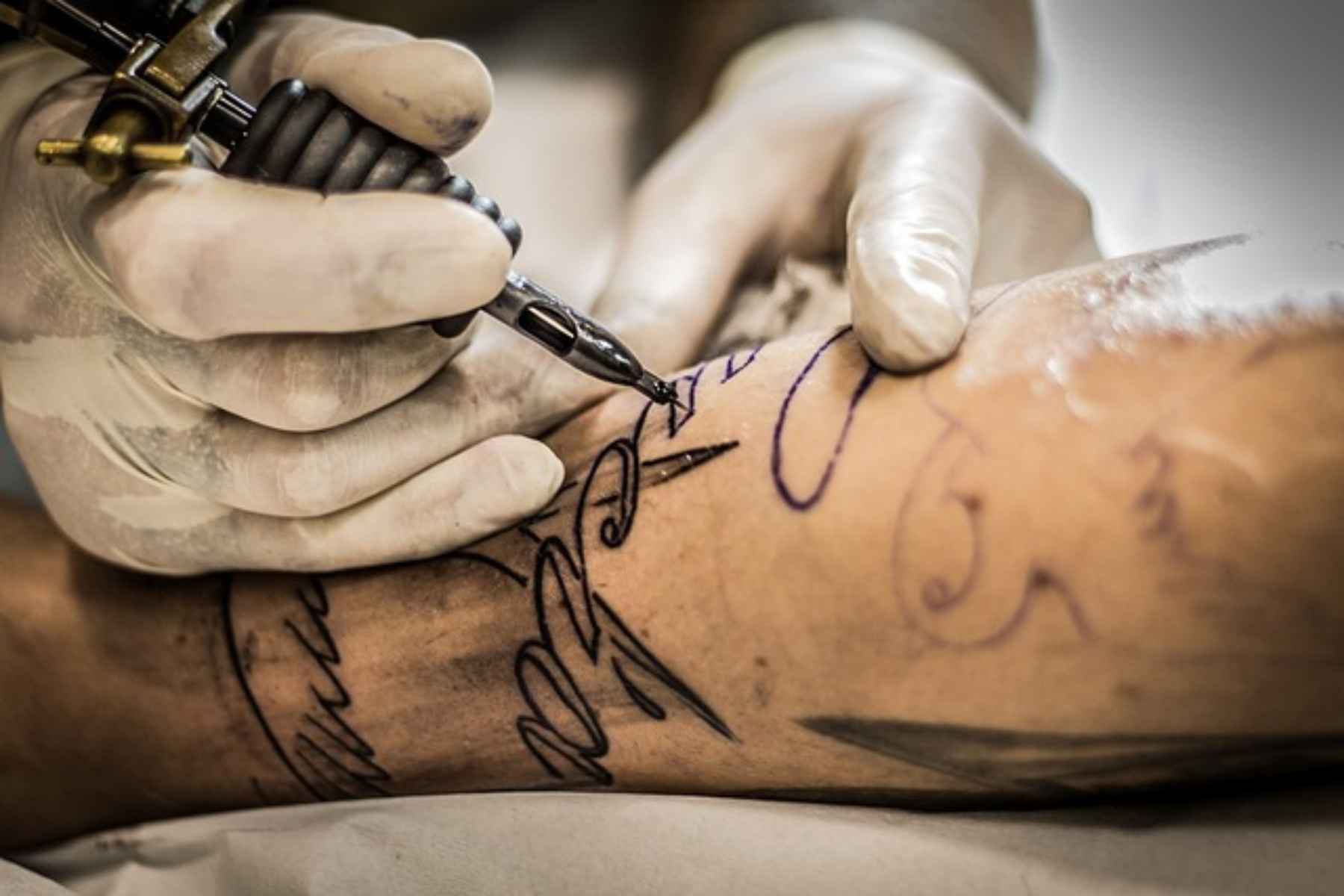 Πώς γίνεται η αφαίρεση τατουάζ με ασφάλεια;