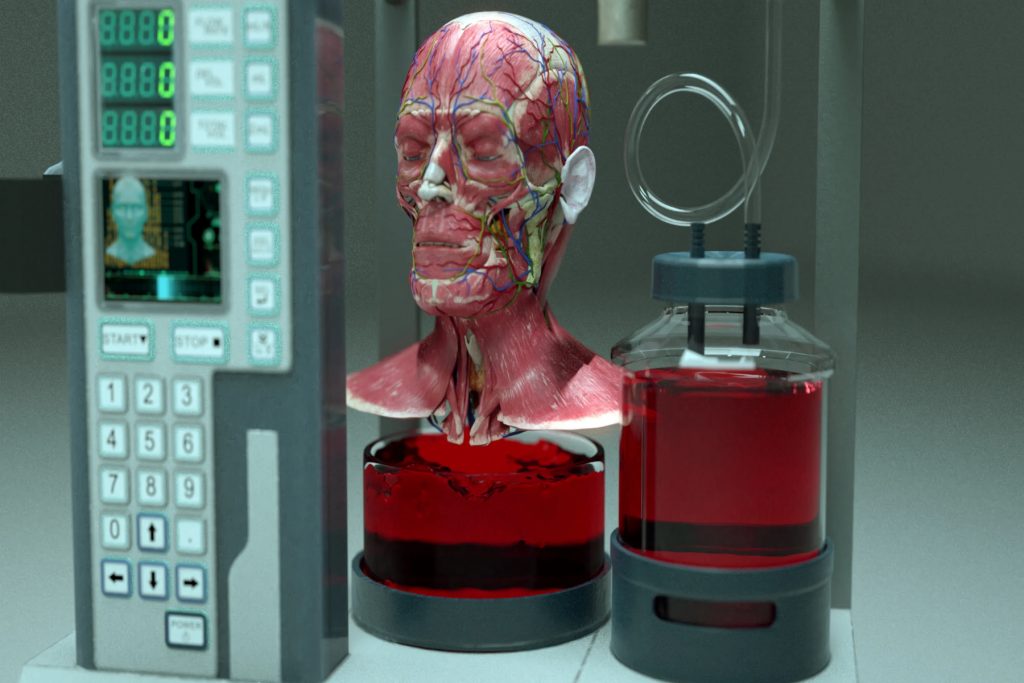 Τα ρομπότ θα μπορούσαν μια μέρα να κάνουν μεταμόσχευση κεφαλιού 