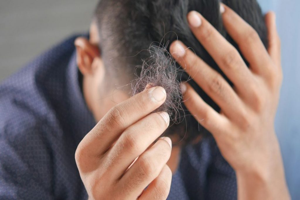 Νέο έμπλαστρο υπόσχεται την αναγέννηση των μαλλιών που χάθηκαν στην γυροειδή αλωπεκία
