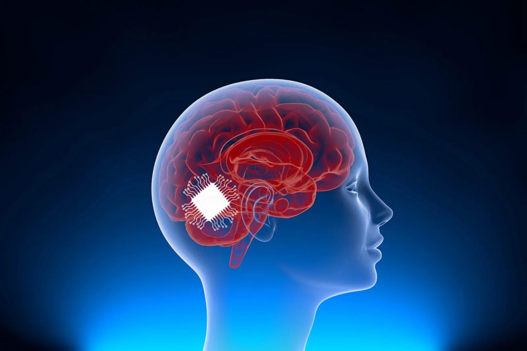 Eμφύτευμα εγκεφάλου AI για επιζήσαντες εγκεφαλικού και για την επικοινωνία τους στα Αγγλικά και Ισπανικά