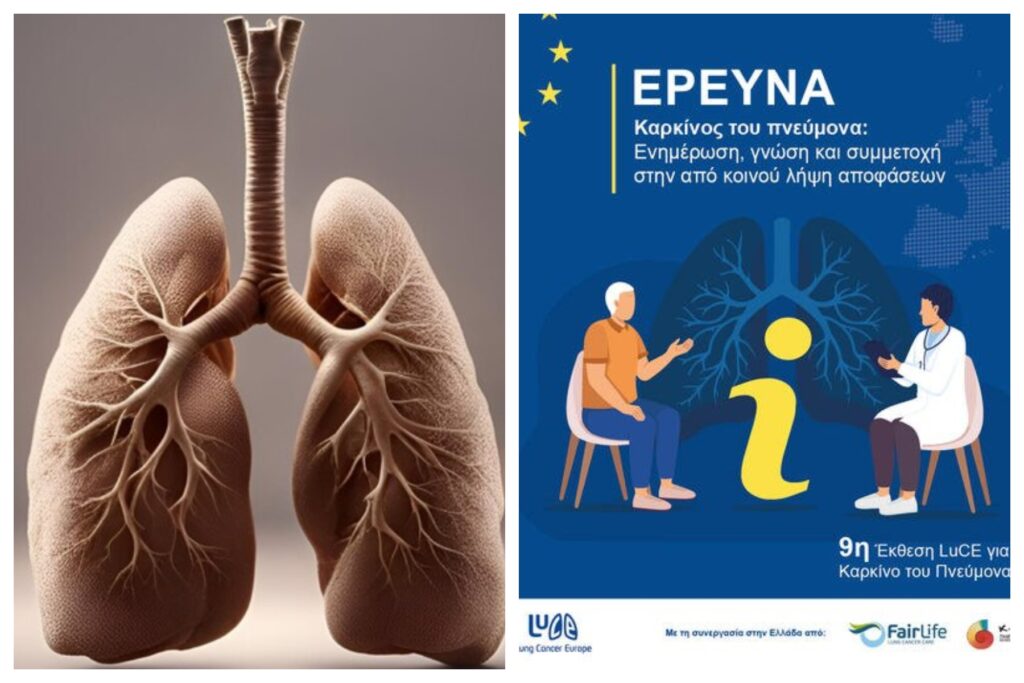 ΚΕΦΙ: Έρευνα LuCE για τον καρκίνο του πνεύμονα - 2024