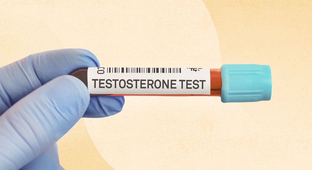 Υψηλότερh τεστοστερόνη συνδέetαι με μειωμένο κίνδυνο εμφάνισης διαβήτη τύπου 2 σε άνδρες κάτω των 65 ετών