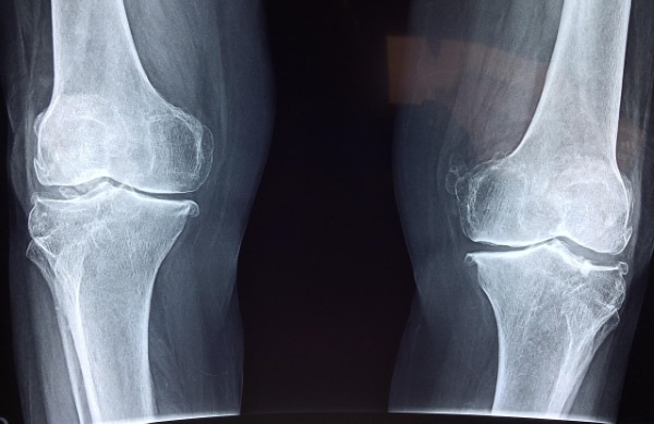 Καλή Επιλογή για Χορτοφάγους και Νηστεία