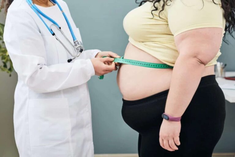 Χειρουργοί: Η παχυσαρκία είναι θεραπεύσιμη ιατρική πάθηση