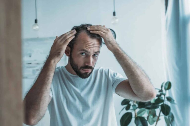 Τριχόπτωση: Η θαυματουργή τροφή που την σταματά και την έχεις ήδη στην κουζίνα σου