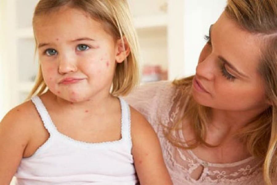 stafylokokkos sto paidi ti prepei na kseroun oi goneis 1