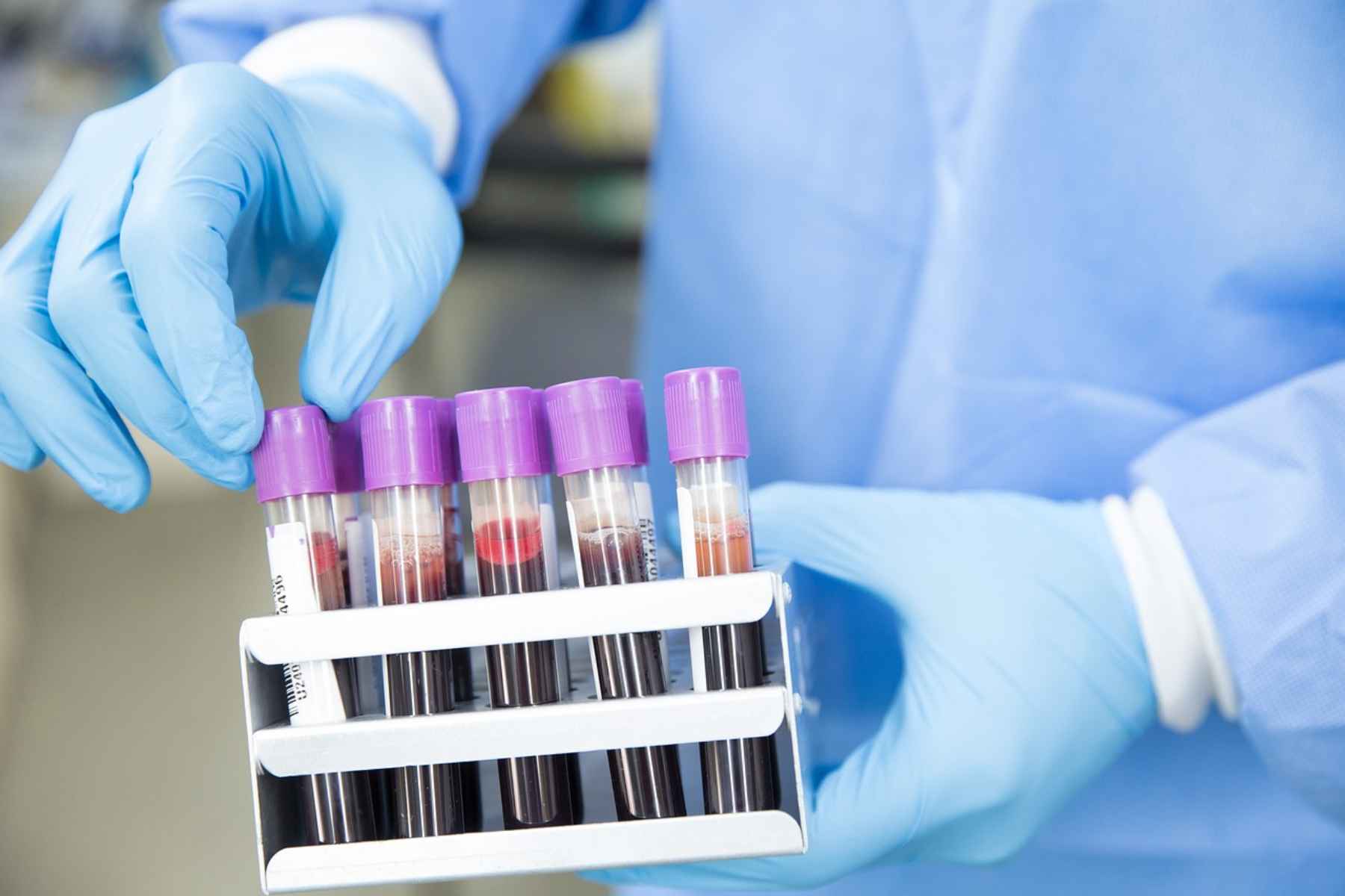 Έρευνα: Αποκωδικοποιώντας το «ντόμινο» των παθήσεων 